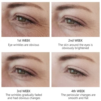 Eye Serum ELAVAT GLAMUURI silmakreem Retinool Emulsioon Vähendab peeneid Jooni Silmade Ümber ja Niisutab Silma Skin Care